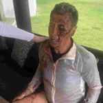 Comrades Marathon winner Nick Bester viciously attacked