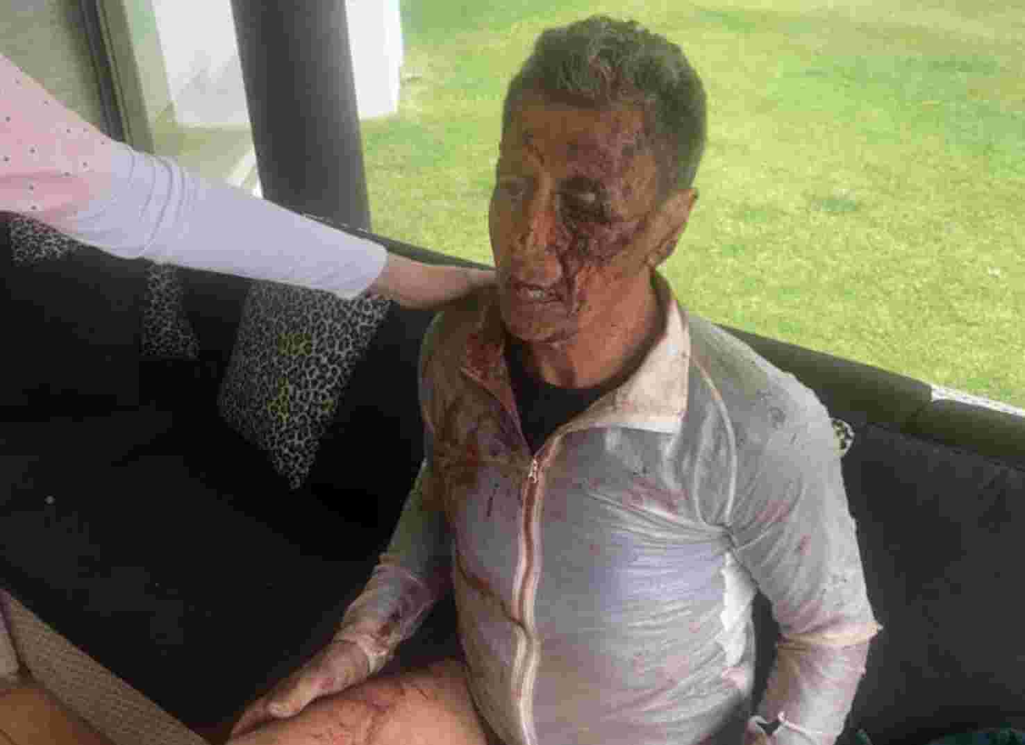 Comrades Marathon winner Nick Bester viciously attacked