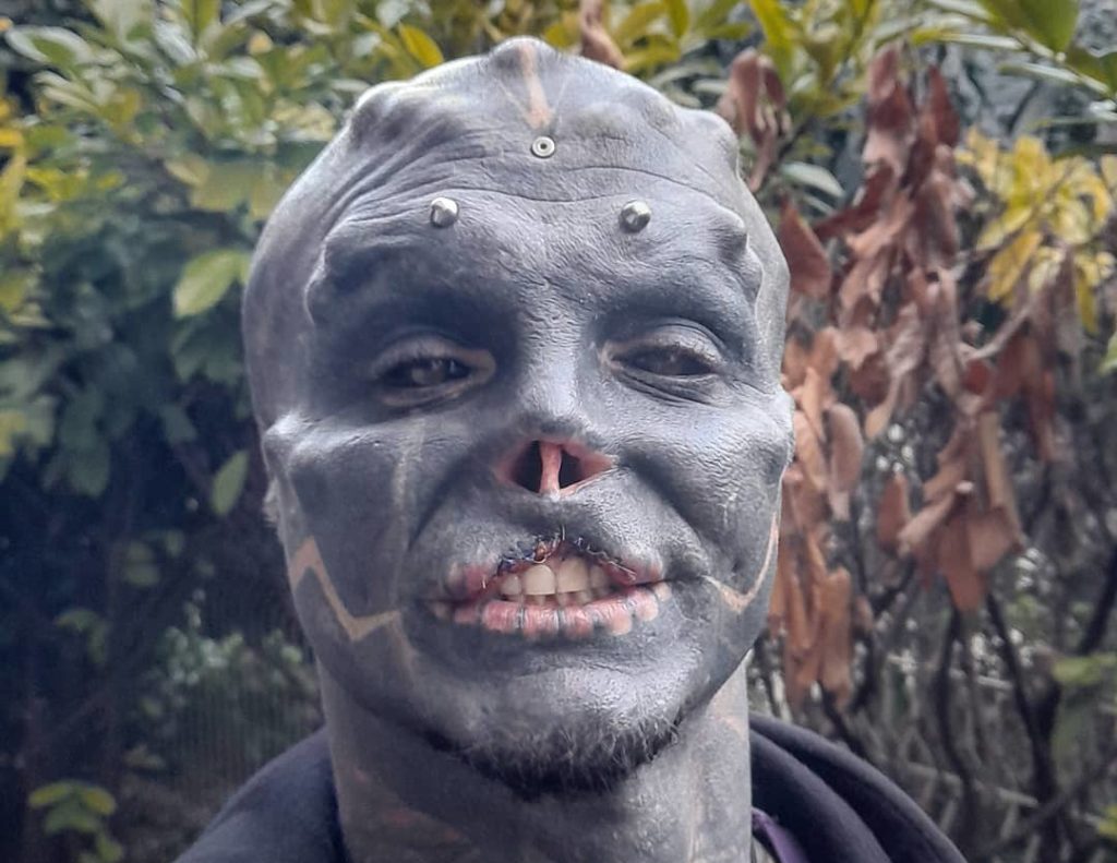 Man cuts off nose and upper lip to become 'black alien'