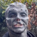 Man cuts off nose and upper lip to become 'black alien'